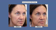 Load image into Gallery viewer, PRE-ORDER: ageLOC® Tru Face® Peptide Retinol Complex