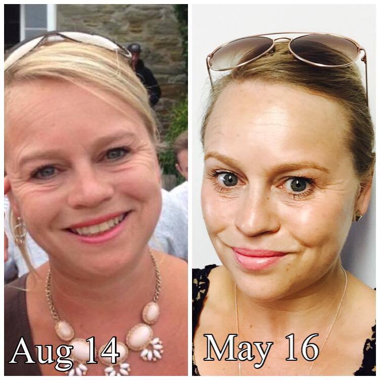 ageLOC Galvanic Facial Spa Beauty Pack – a luminous glow